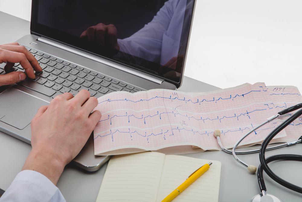 Understanding ECG: What It Is, How It Works, and Why It Matters